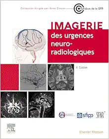 Imagerie des urgences neuroradiologiques (True PDF from Publisher)