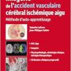 Imagerie de l’accident vasculaire cérébral ischémique aigu: Méthode d’auto-apprentissage (EPUB)