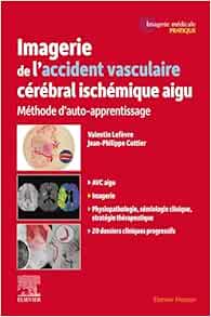 Imagerie de l’accident vasculaire cérébral ischémique aigu: Méthode d’auto-apprentissage (EPUB)