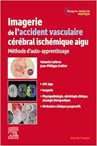 Imagerie de l’accident vasculaire cérébral ischémique aigu: Méthode d’auto-apprentissage (Original PDF from Publisher)