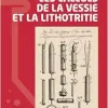 Les calculs de la vessie et la lithotritie (French Edition) (Original PDF from Publisher)