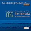 Atlas of electroencephalography:The Epilepsies. EEG and epileptic syndromes, Volume 2 (Original PDF from Publisher)