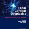 Focal Cortical Dysplasias: New advances for curing epilepsy (Original PDF from Publisher)
