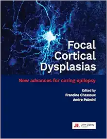 Focal Cortical Dysplasias: New advances for curing epilepsy (Original PDF from Publisher)