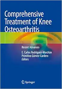 Comprehensive Treatment of Knee Osteoarthritis: Recent Advances, 2020th Edition (EPUB)