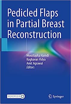 Pedicled Flaps in Partial Breast Reconstruction (EPUB)