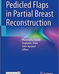 Pedicled Flaps in Partial Breast Reconstruction (Original PDF from Publisher)