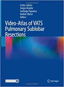 Video-Atlas of VATS Pulmonary Sublobar Resections (Original PDF from Publisher)
