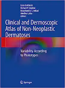 Clinical and Dermoscopic Atlas of Non-Neoplastic Dermatoses: Variability According to Phototypes (Original PDF from Publisher)