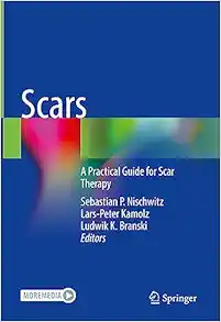 Scars: A Practical Guide for Scar Therapy (Original PDF from Publisher)