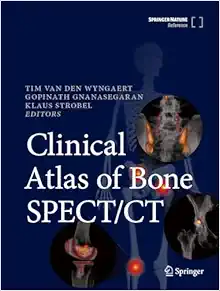 Clinical Atlas of Bone SPECT/CT (EPUB)