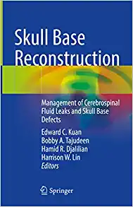 Skull Base Reconstruction: Management of Cerebrospinal Fluid Leaks and Skull Base Defects (Original PDF from Publisher)