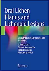 Oral Lichen Planus and Lichenoid Lesions: Etiopathogenesis, Diagnosis and Treatment (Original PDF from Publisher)