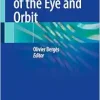Echography of the Eye and Orbit (Original PDF from Publisher)