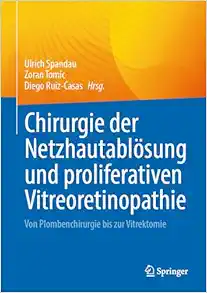 Chirurgie der Netzhautablösung und proliferativen Vitreoretinopathie: Von Plombenchirurgie bis zur Vitrektomie (German Edition) (Original PDF from Publisher)