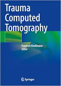 Trauma Computed Tomography (EPUB)