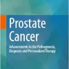 Prostate Cancer: Advancements in the Pathogenesis, Diagnosis and Personalized Therapy (Original PDF from Publisher)
