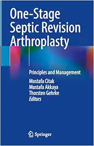 One-Stage Septic Revision Arthroplasty: Principles and Management (Original PDF from Publisher)