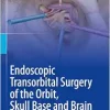 Endoscopic Transorbital Surgery of the Orbit, Skull Base and Brain (EPUB)