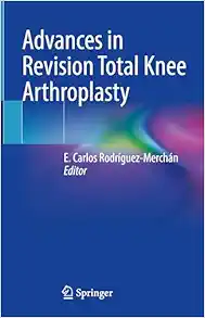 Advances in Revision Total Knee Arthroplasty (EPUB)