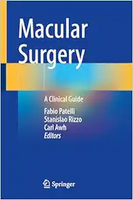 Macular Surgery: A Clinical Guide (EPUB)