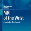 MRI of the Wrist: A Practical Case-Based Approach, 2024th Edition (EPUB)