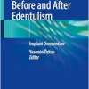 Treatment Options Before and After Edentulism: Implant Overdenture (EPUB)