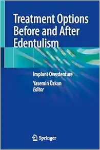 Treatment Options Before and After Edentulism: Implant Overdenture (EPUB)