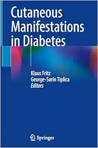 Cutaneous Manifestations in Diabetes (Original PDF from Publisher)