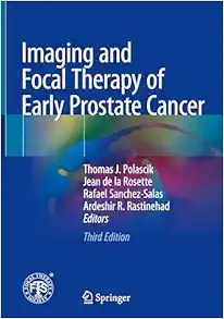 Imaging and Focal Therapy of Early Prostate Cancer, 3rd Edition (Original PDF from Publisher)