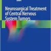 Neurosurgical Treatment of Central Nervous System Tumors (Original PDF from Publisher)