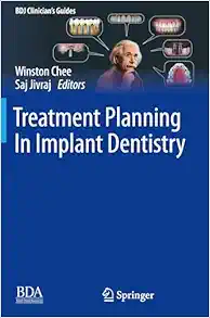 Treatment Planning In Implant Dentistry (BDJ Clinician’s Guides), 2nd Edition (EPUB)