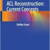 ACL Reconstruction: Current Concepts (EPUB)