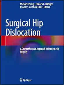 Surgical Hip Dislocation: A Comprehensive Approach to Modern Hip Surgery (EPUB)