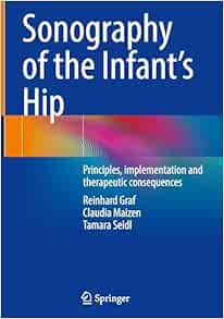 Sonography of the Infant’s Hip: Principles, implementation and therapeutic consequences (EPUB)