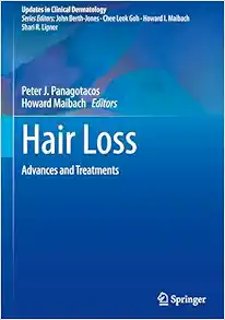 Hair Loss: Advances and Treatments (Updates in Clinical Dermatology) (Original PDF from Publisher)