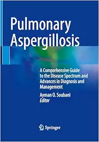 Pulmonary Aspergillosis: A Comprehensive Guide to the Disease Spectrum and Advances in Diagnosis and Management (Original PDF from Publisher)