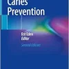 Evidence-Based Caries Prevention, 2nd Edition (Original PDF from Publisher)