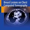 Atlas of Breast Lesions on Chest Computed Tomography (Original PDF from Publisher)