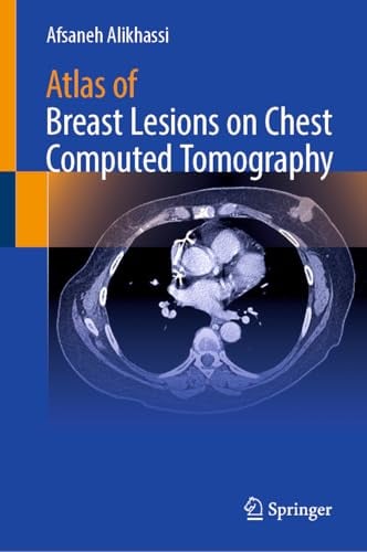 Atlas of Breast Lesions on Chest Computed Tomography (EPUB)