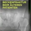 Beckenfraktur beim älteren Patienten (German Edition) (Original PDF from Publisher)