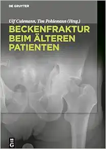 Beckenfraktur beim älteren Patienten (German Edition) (EPUB)
