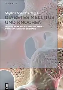 Diabetes Mellitus und Knochen: Osteoporose als Folgeerkrankung: Konsequenzen für die Praxis (German Edition) (EPUB)