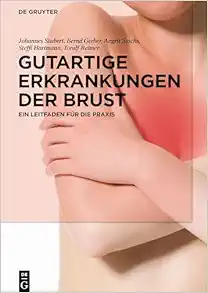 Gutartige Erkrankungen der Brust: Ein Leitfaden für die Praxis (German Edition) (Original PDF from Publisher)