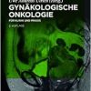 Gynäkologische Onkologie: für Klinik und Praxis, 2nd Edition (German Edition) (EPUB)