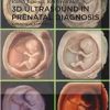 3D Ultrasound in Prenatal Diagnosis: A Practical Approach, 2nd Edition (Original PDF from Publisher)