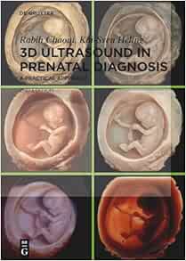 3D Ultrasound in Prenatal Diagnosis: A Practical Approach, 2nd Edition (Original PDF from Publisher)