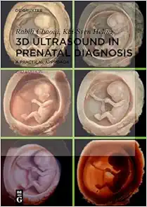 3D Ultrasound in Prenatal Diagnosis: A Practical Approach, 2nd edition (Original PDF from Publisher)