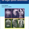 Corrective Osteotomies for Rigid Spinal Deformities (Original PDF from Publisher)