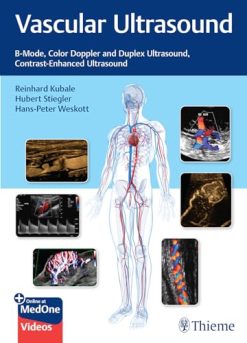 Vascular Ultrasound: B-Mode, Color Doppler and Duplex Ultrasound, Contrast-Enhanced Ultrasound (EPUB)